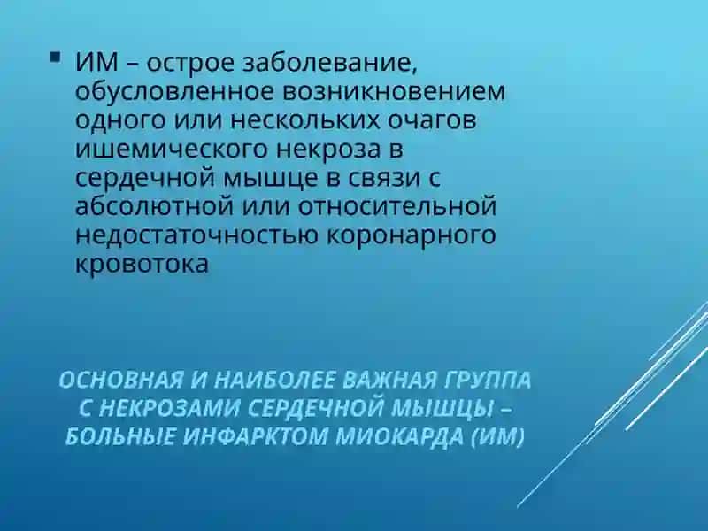 Инфаркт миокарда 3