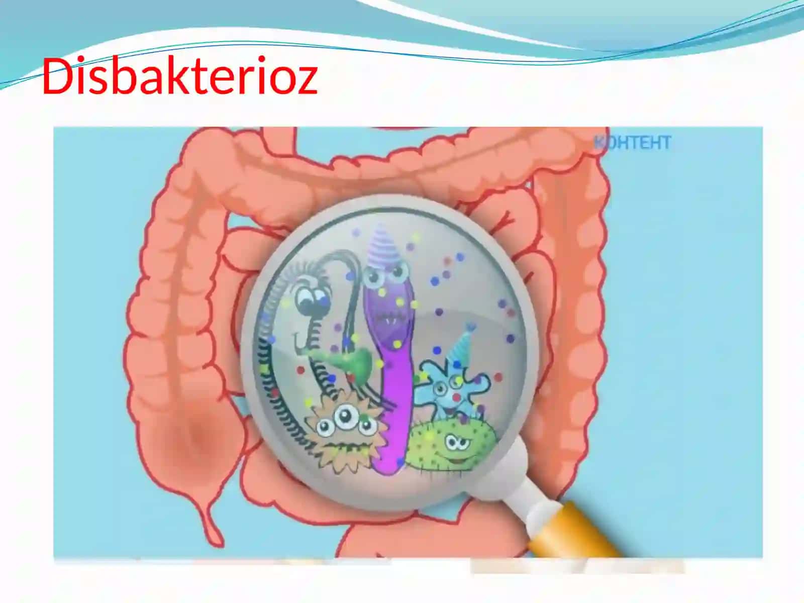 Disbakterioz 3