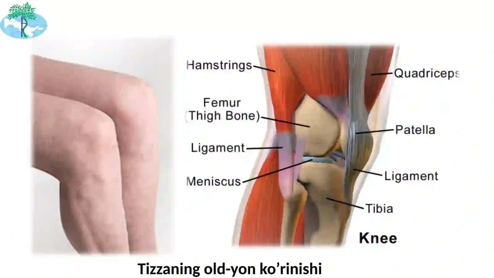 Tizza bo’g’imi shikastlanishlari 3