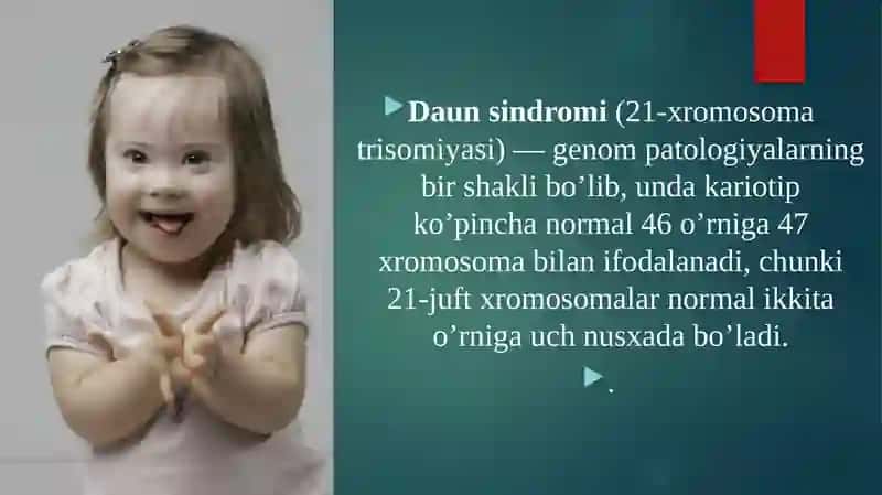 Daunsindromi 3