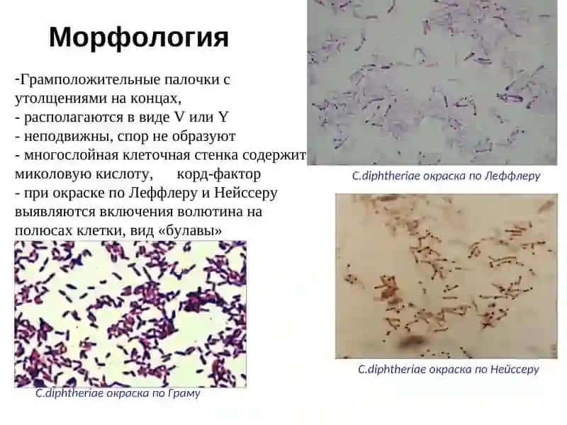 Corynebacterium diphtheriae 3