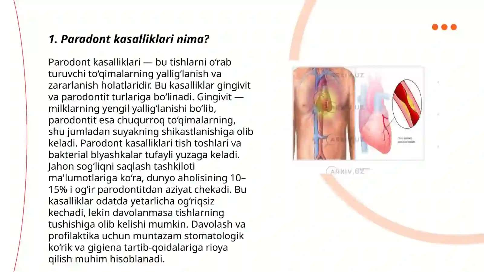 Paradont kasalliklari 3