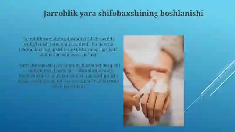 Bemorlarda xirurgik stomani parvarish qilish 3