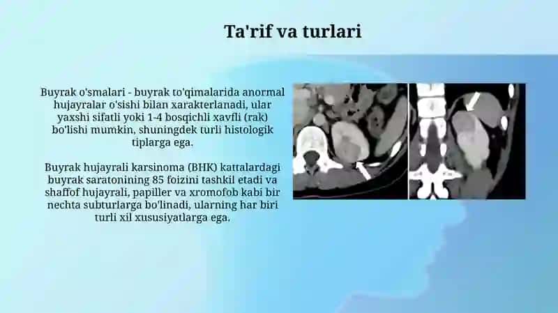 Buyrakoʻsmalari 3