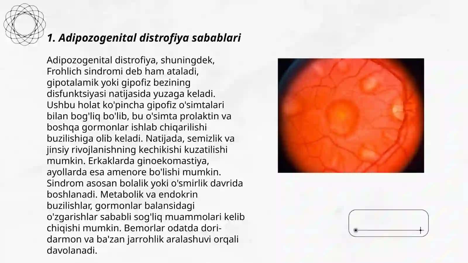 Adipozogenital distrofiya 3