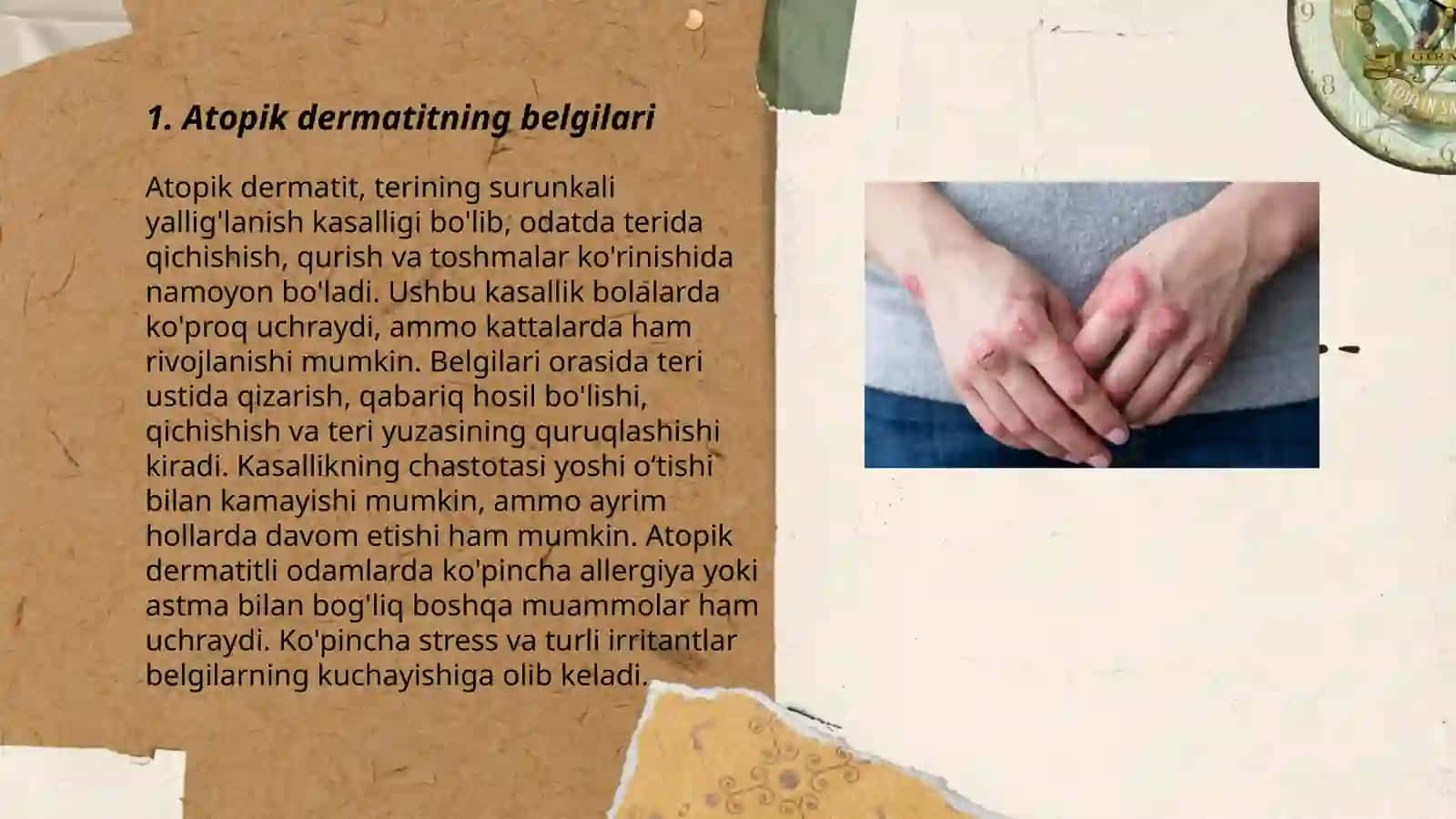 Atopik dermatit 3