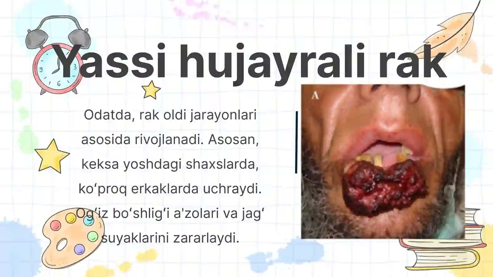 Lab qizil hoshiyasi 3