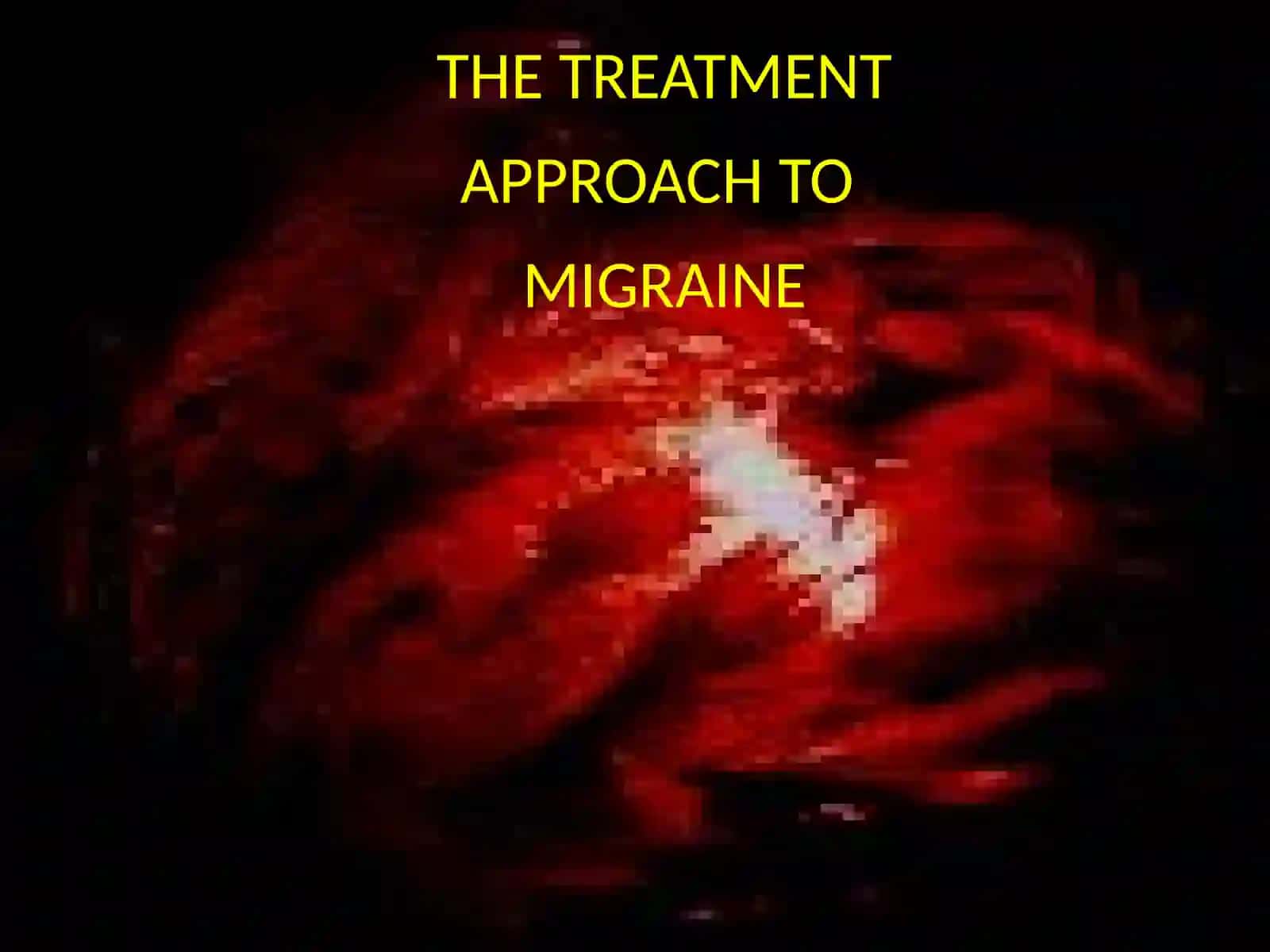 Migraine novel pharmacotherapy 3
