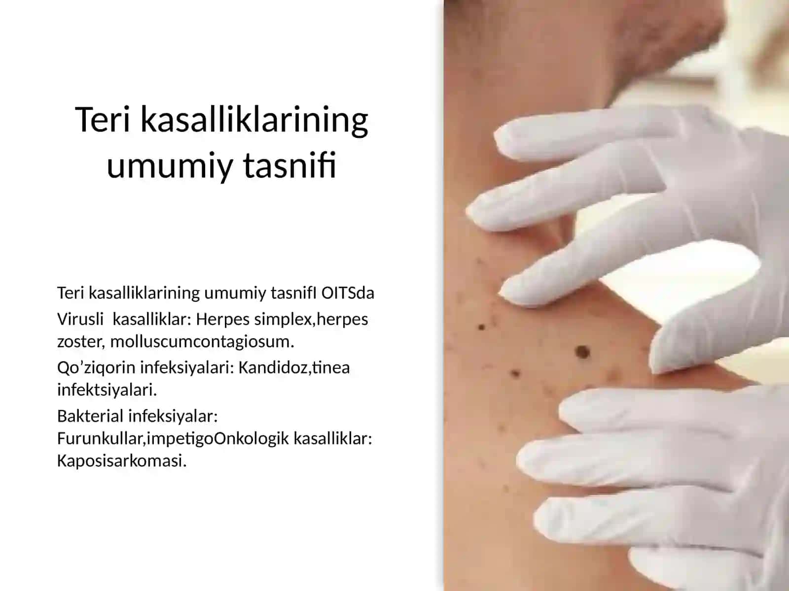 OITSda teri kasalliklari 3