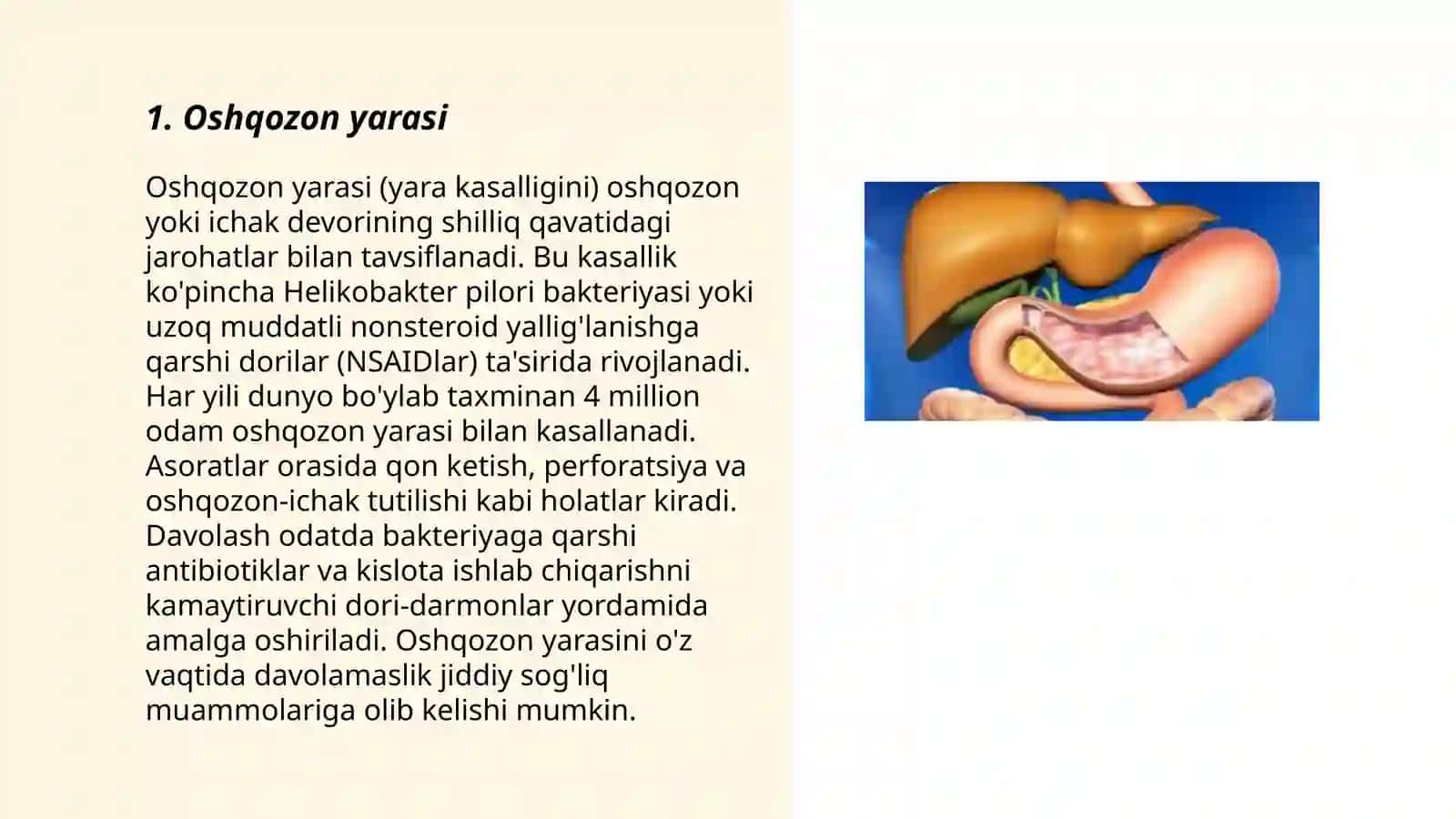 Oshqozon yarasi 3