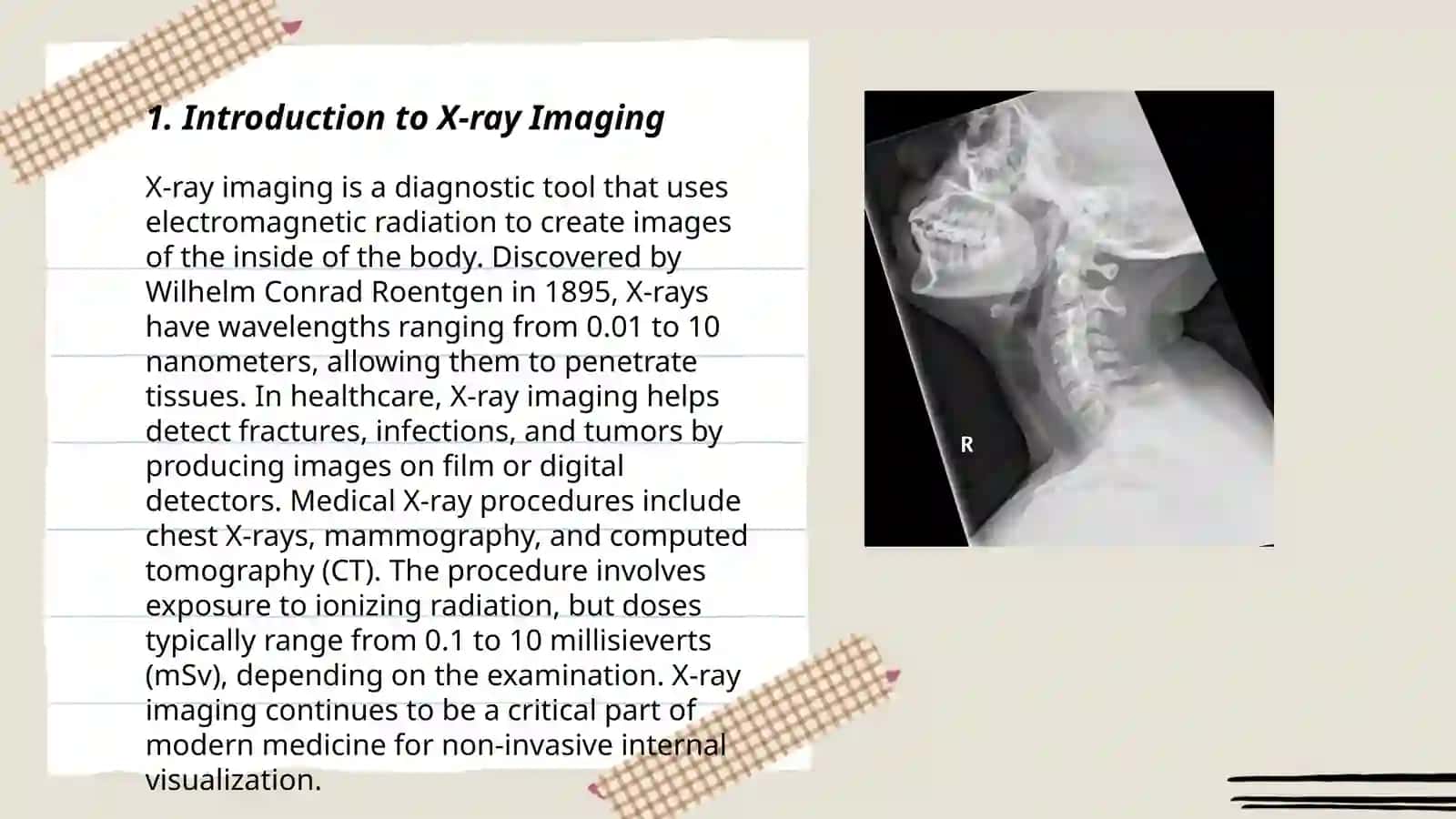 Basic in investigations X-ray, MKI. USI 3