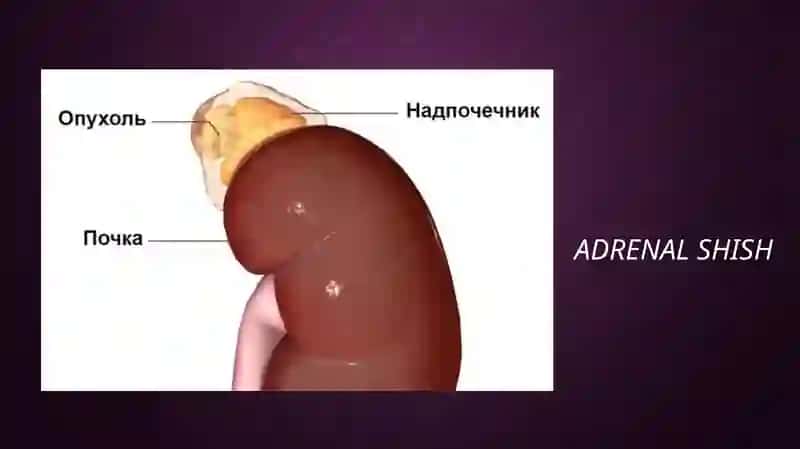 Konnsindromi 3