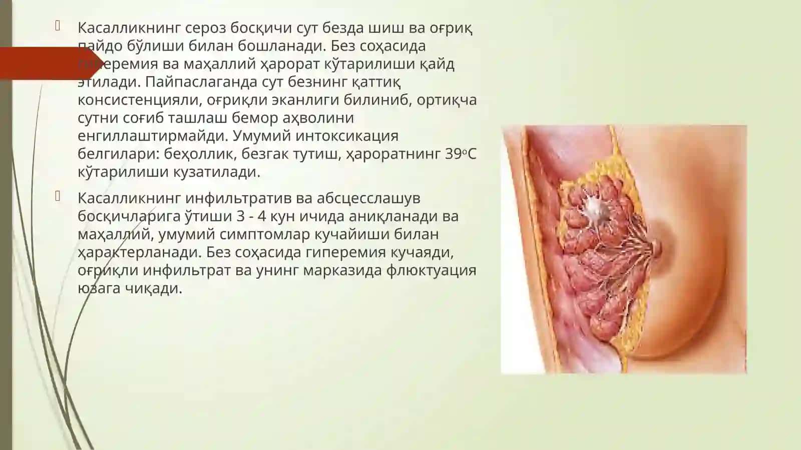 Мастит-Сутбезининг йирингли яллиғланиши 3