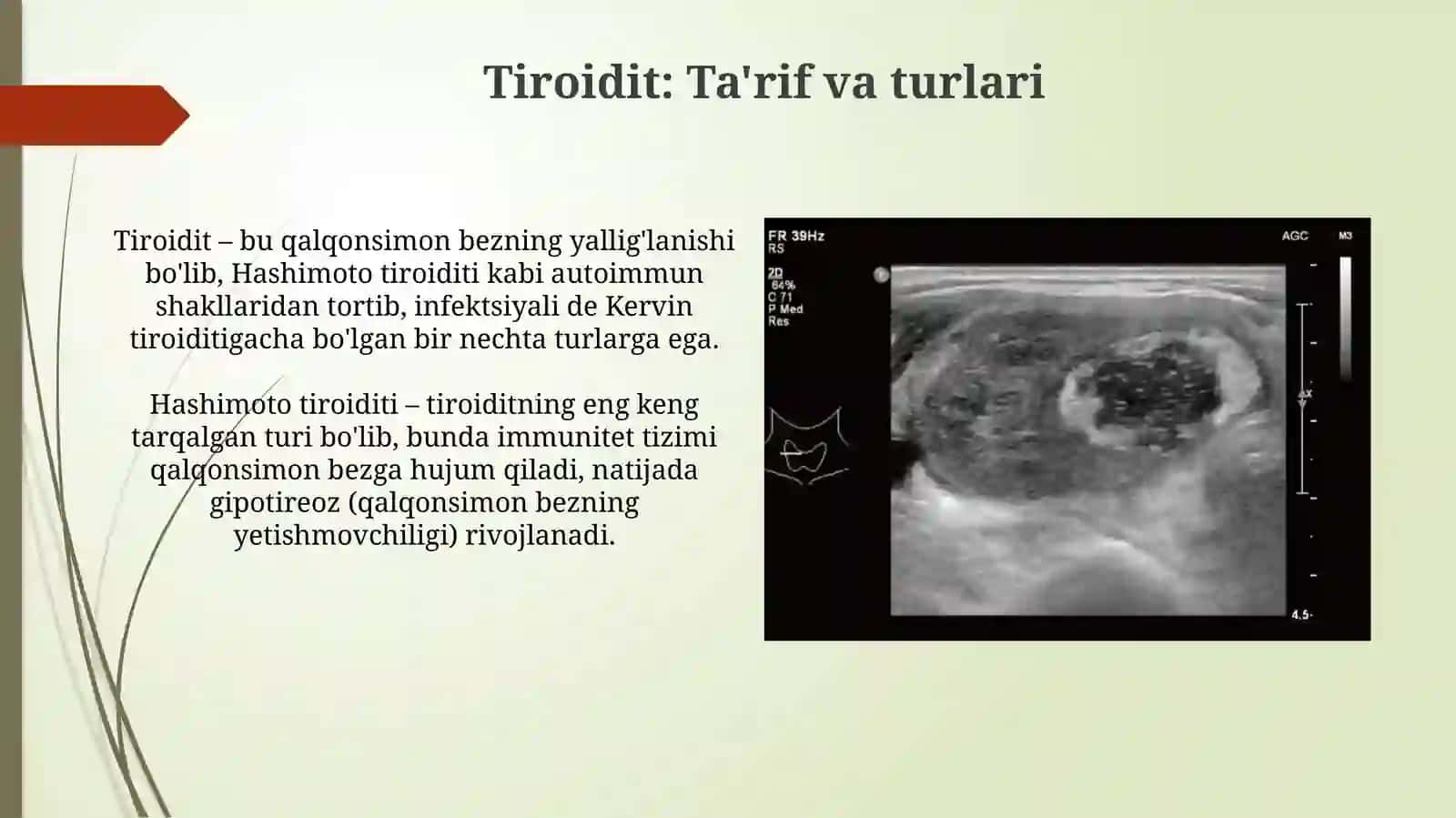 Tiroidit 3