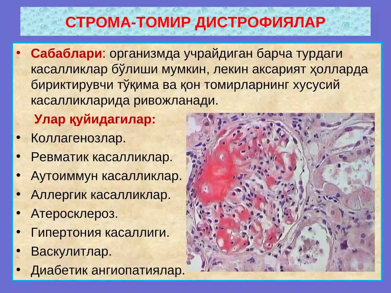 СТРОМА-ТОМИР ДИСТРОФИЯЛАР 3