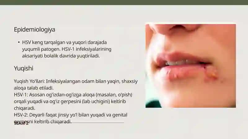Oʼtkir gerpes virus 3