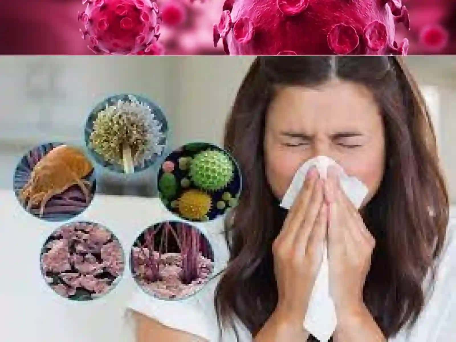 Allergiya 3