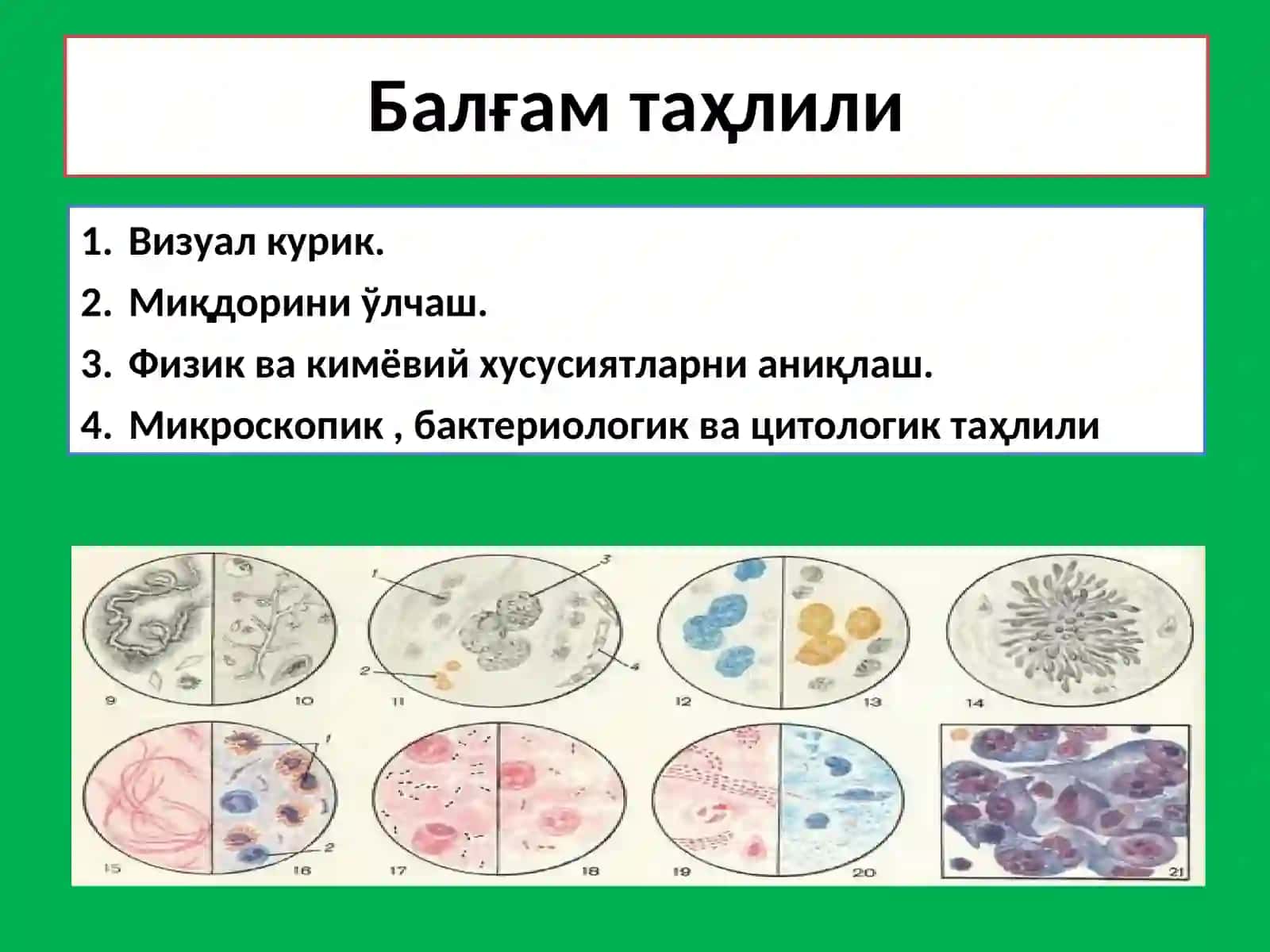 Балғам Таҳлили 3
