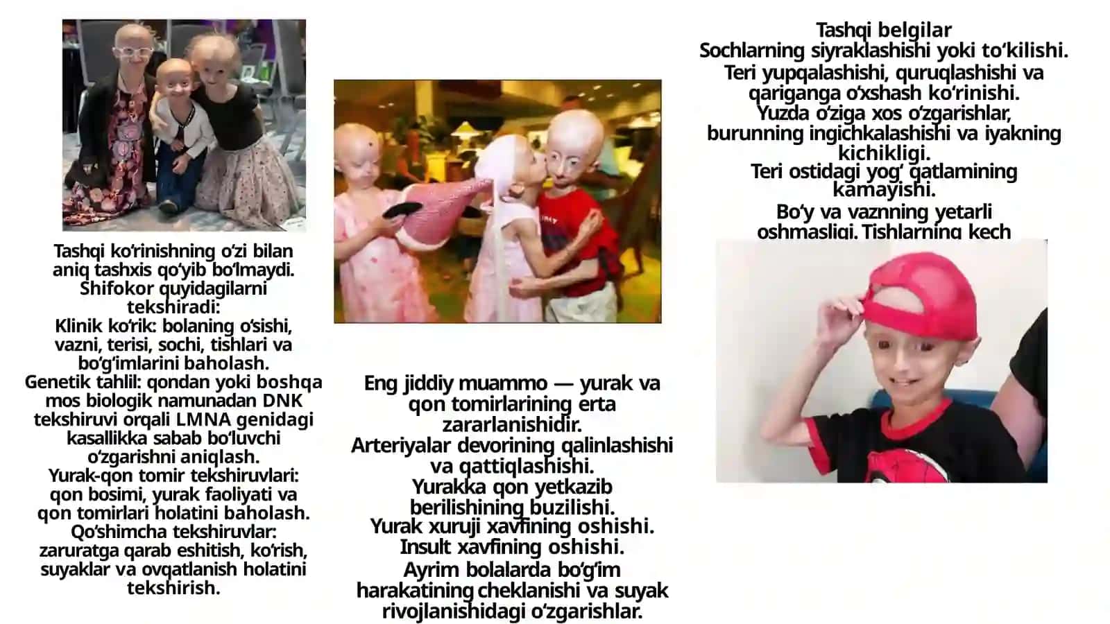 Progeriya 3