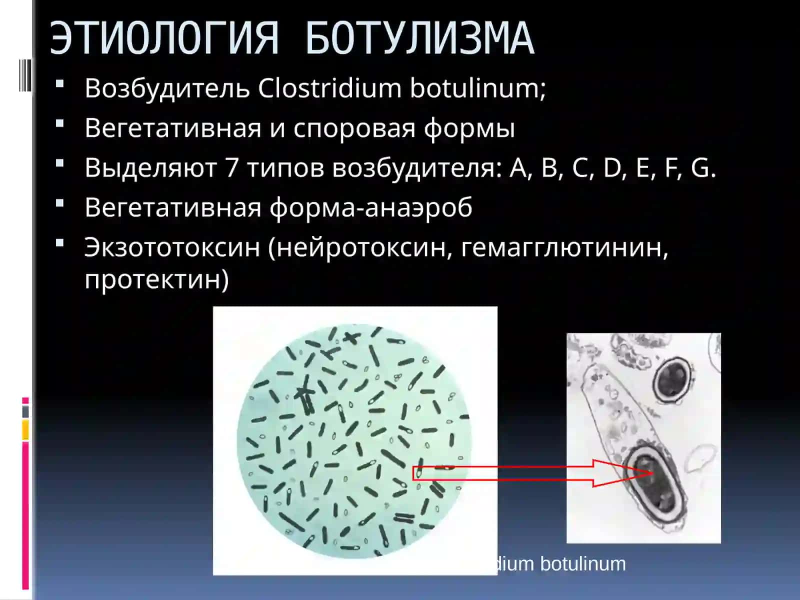 БОТУЛИЗМ 3