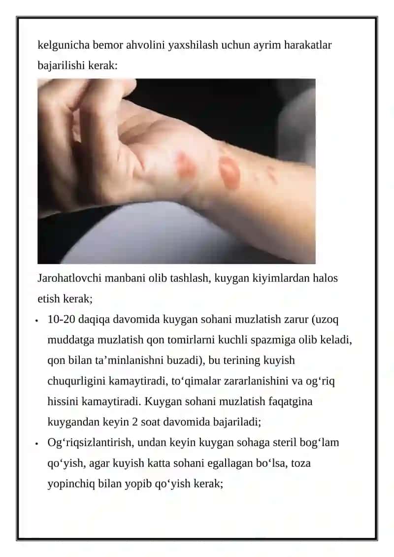 TERMIK SHIKASTLANISHLAR 3