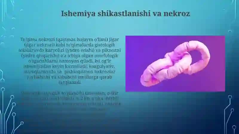 Idrokpatologiyasi 3