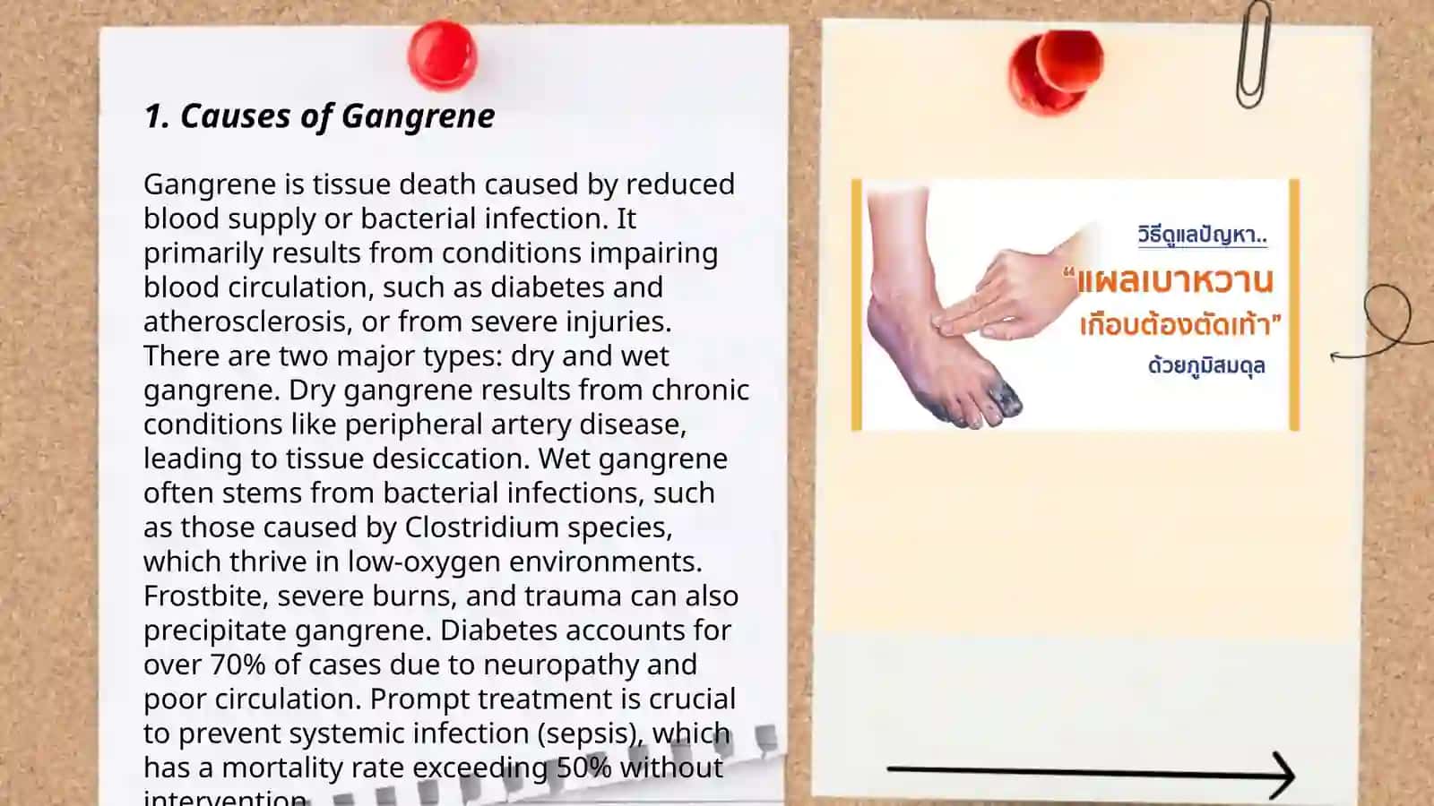 Gangrene 3