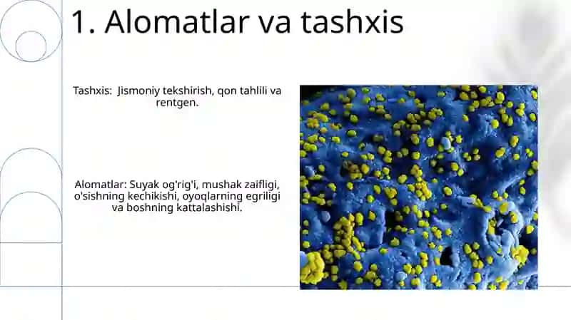 Raxit kasalligi 3