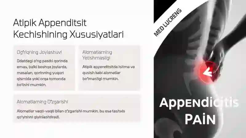 Oʻtkir Appenditsit Atipik Kechishi 3