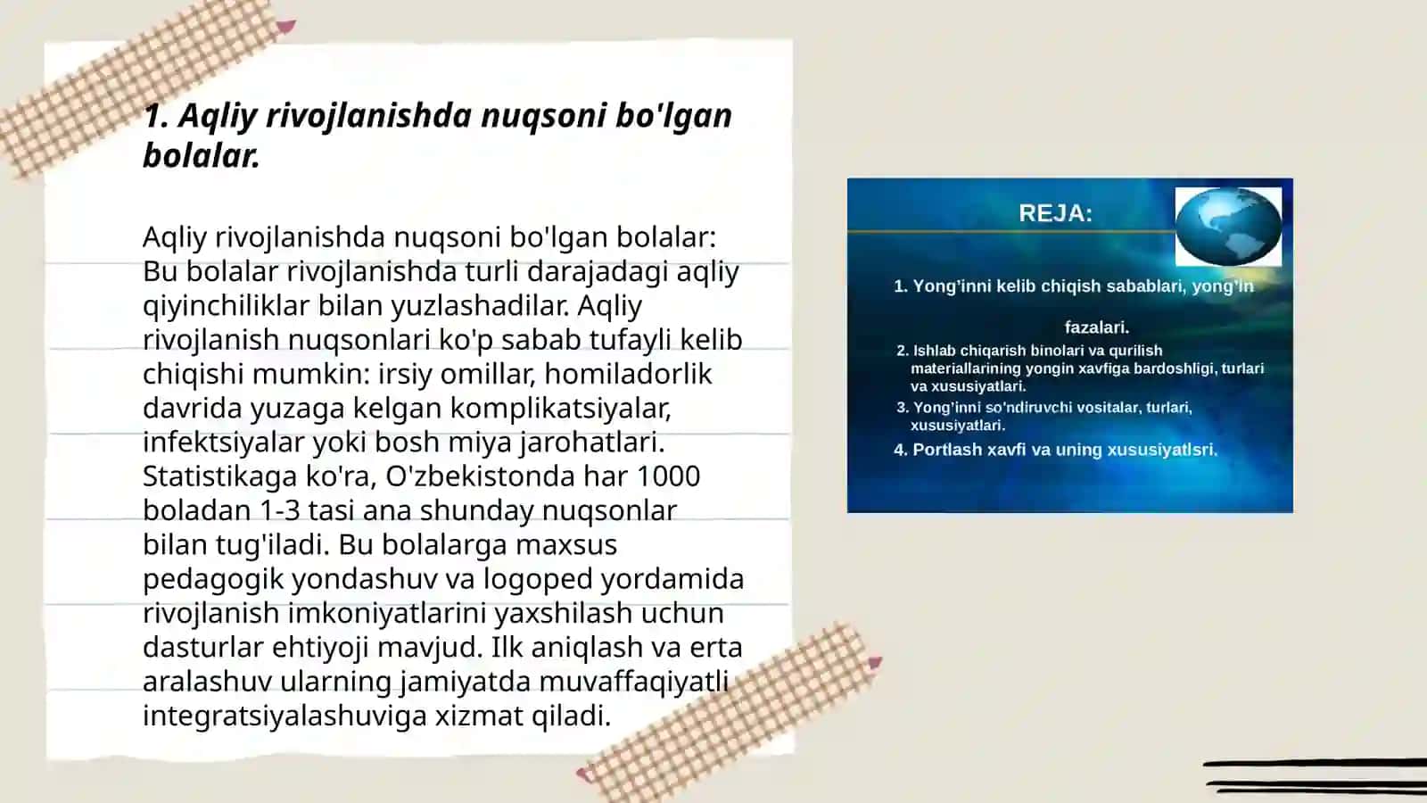Daun sindromli bolalar 3