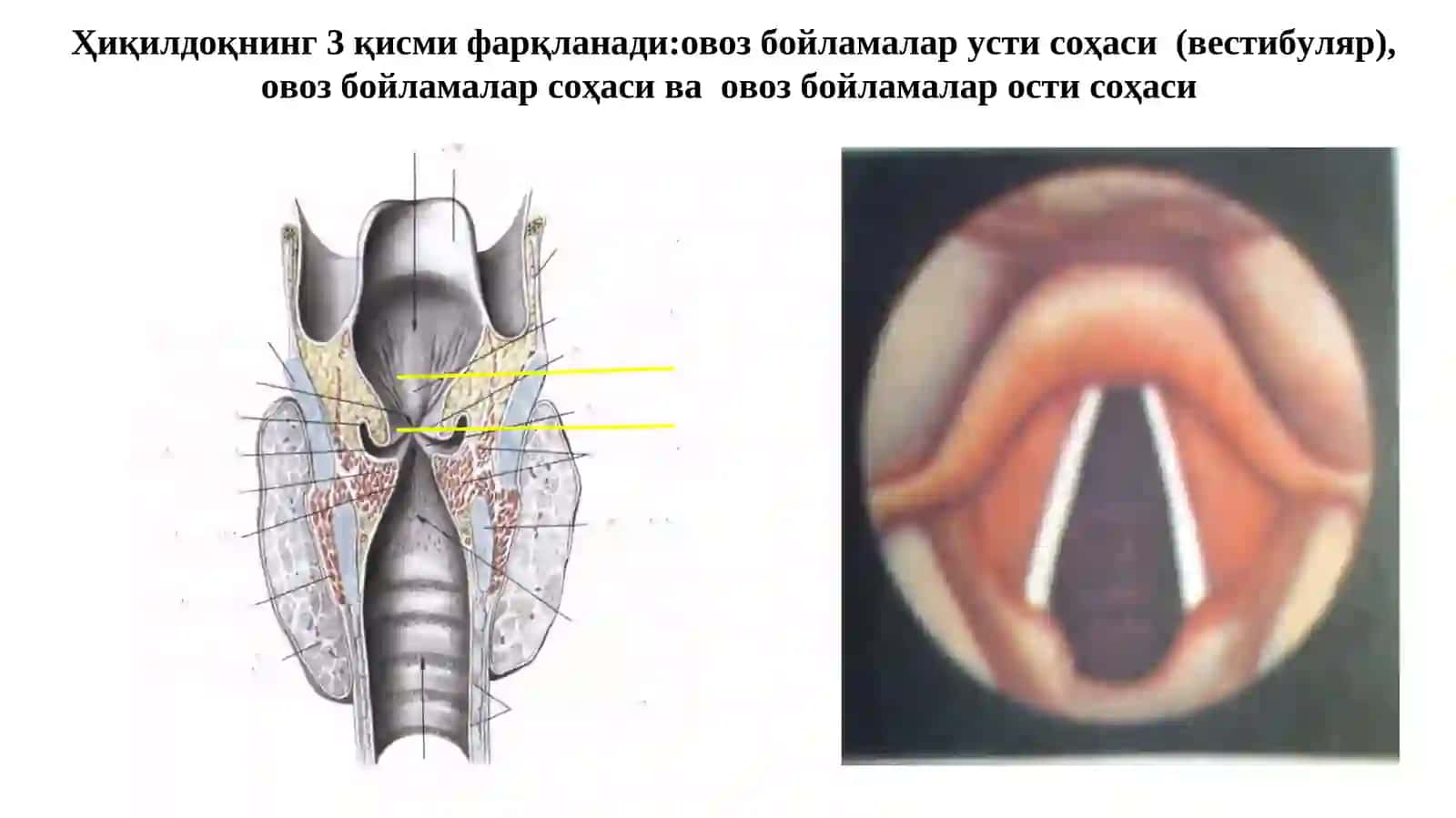 hiqildoq raki 3