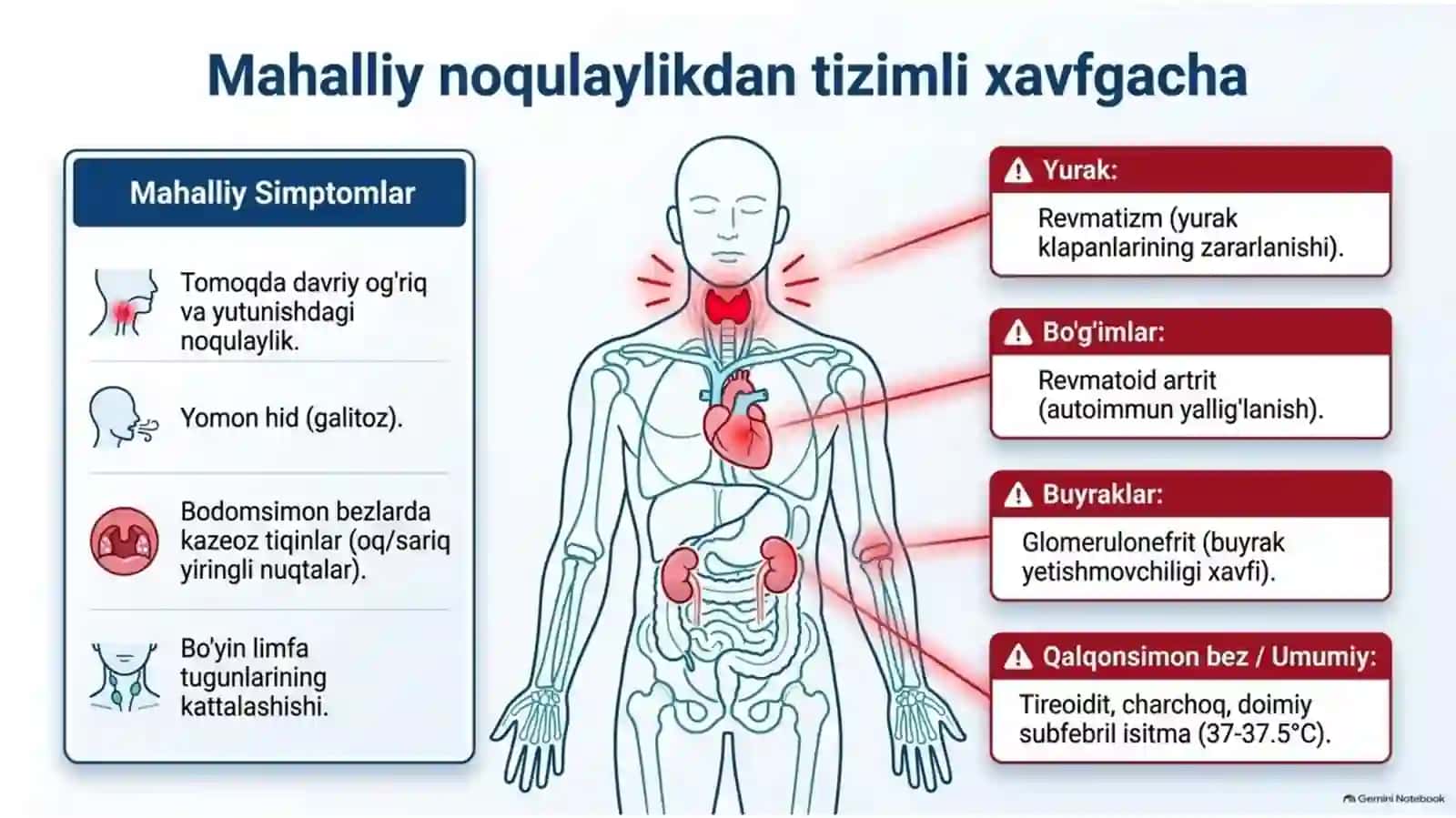 Surunkaliy tonzilit 3
