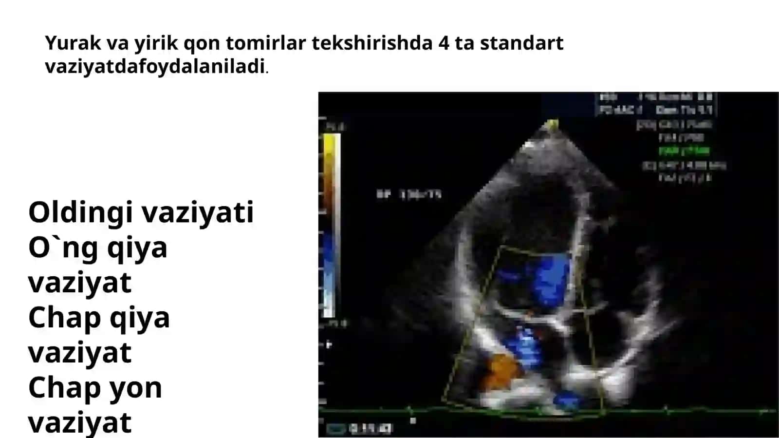 Yurak va yirik qon tomirlari tekshirish 3