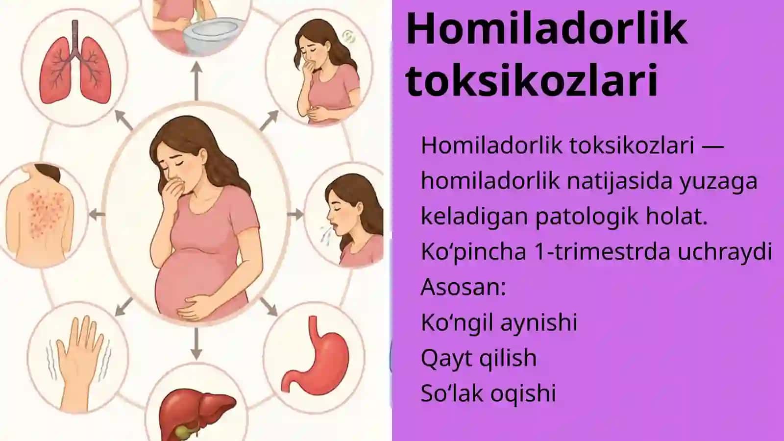 Homiladorlik toksikozlari 3