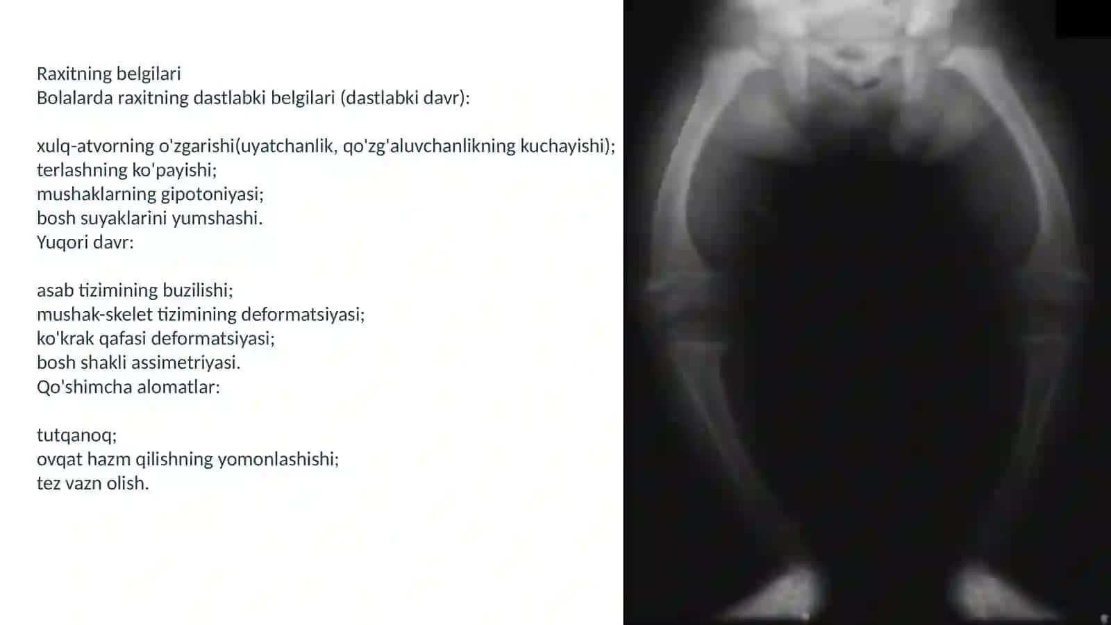 Raxit kasalligi 3