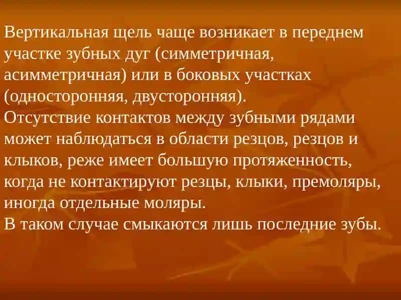 ОТКРЫТЫЙ ПРИКУС 3
