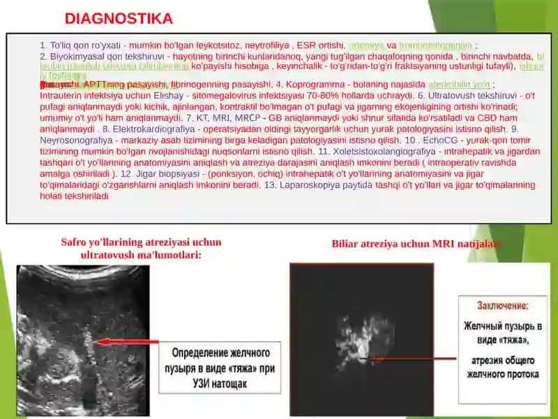 Xoletsistopatiya 3