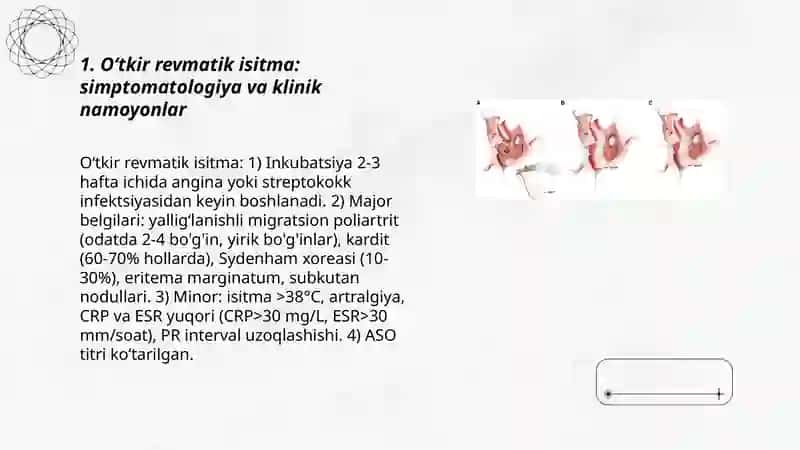 Yurak Ritmini Buzilish Sindromi 3
