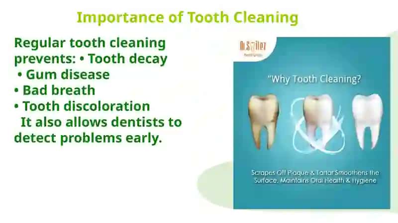 Tooth cleanings 3