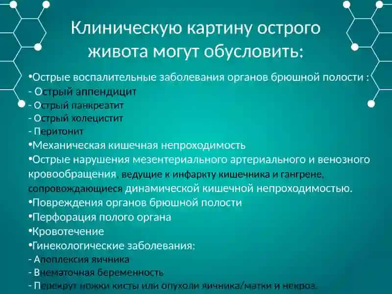 Острый живот 3