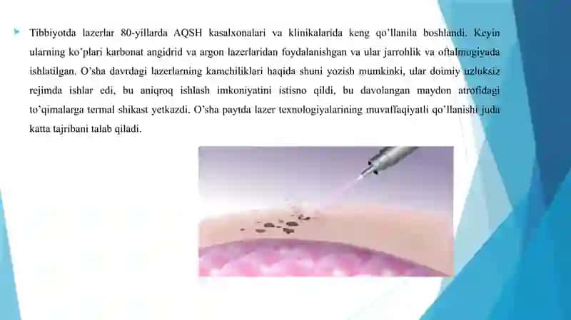 Lazerning tibbiyotda qo’llanishi 3