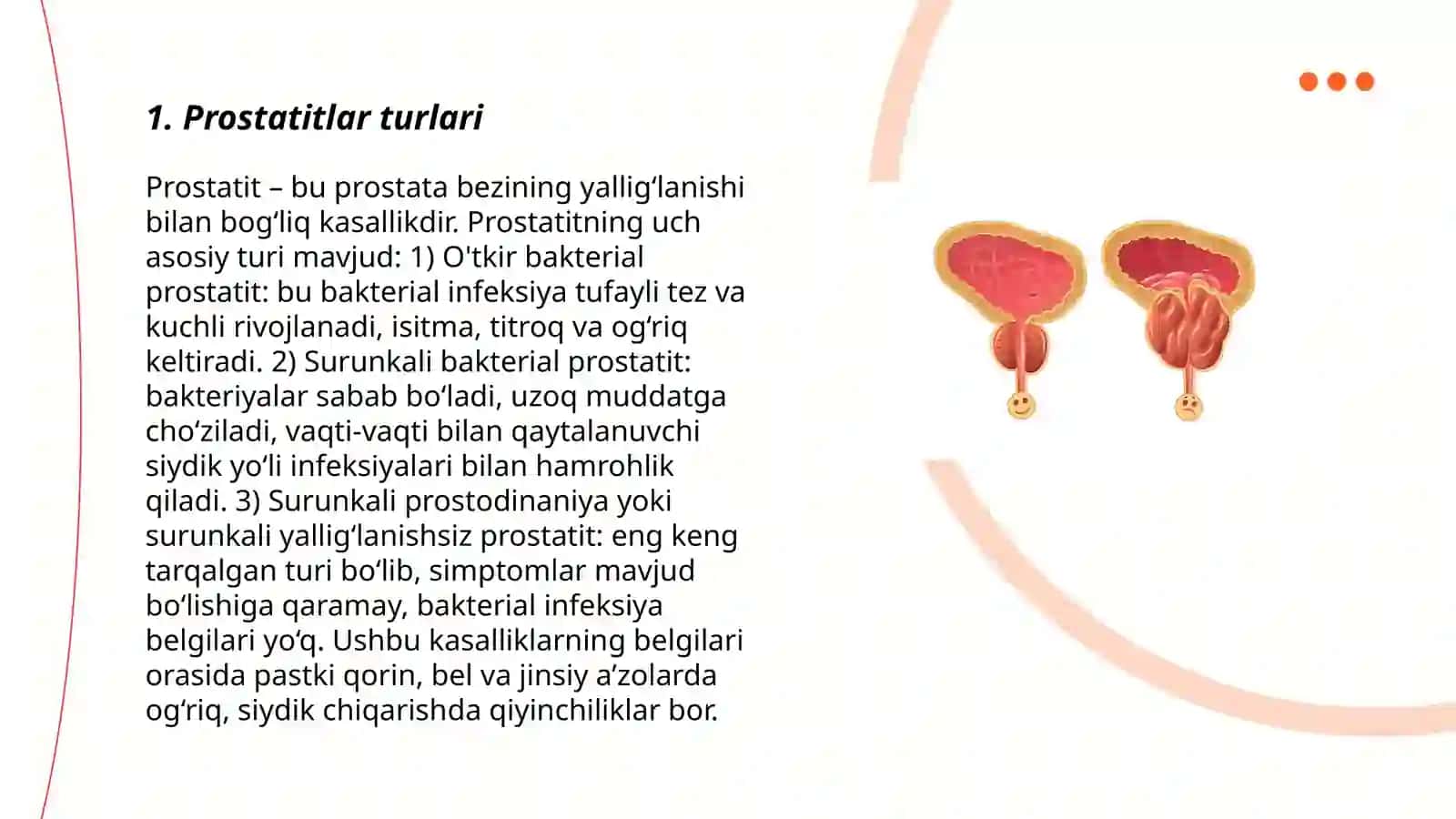 Prostata bezi kasalliklari 3