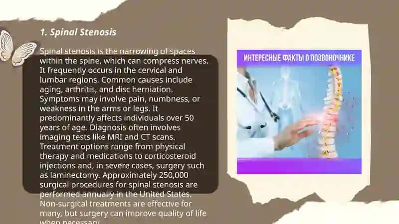 Spinal Stenosis 3