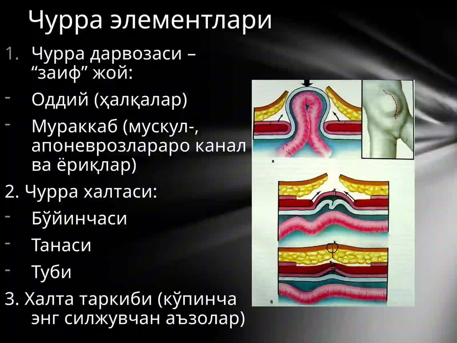 Қорин чурралари 3