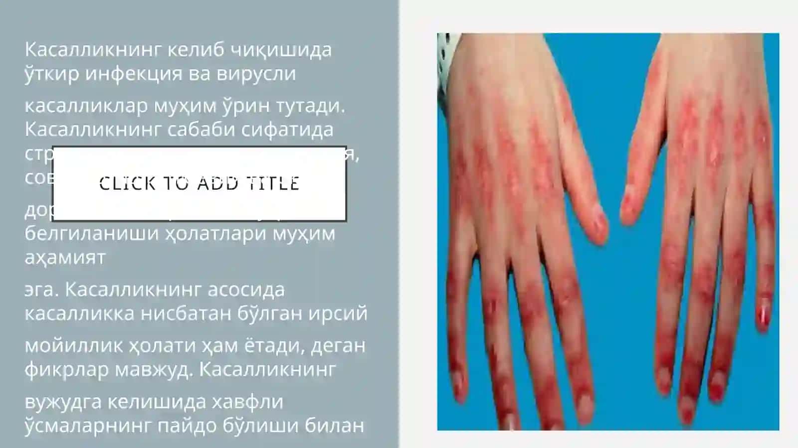 Dermatomiozitlar. Vitiligoning zamonaviy davolash usullari 3