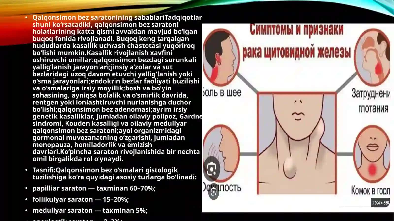 QALQONSIMON BEZ SARATONI 3