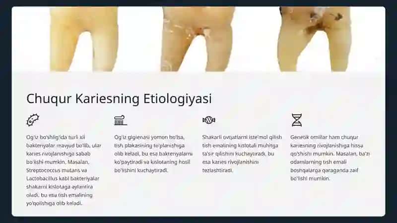 Karies kasalligi va uning tasnifi 3