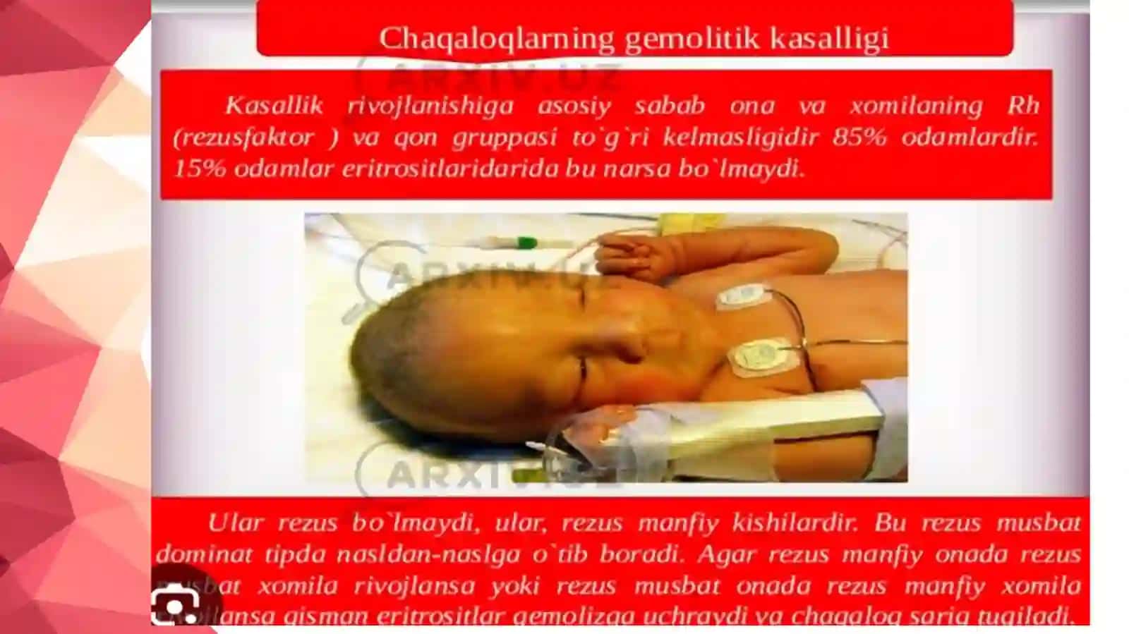 Chaqaloqlargemolitikkasalligi 3