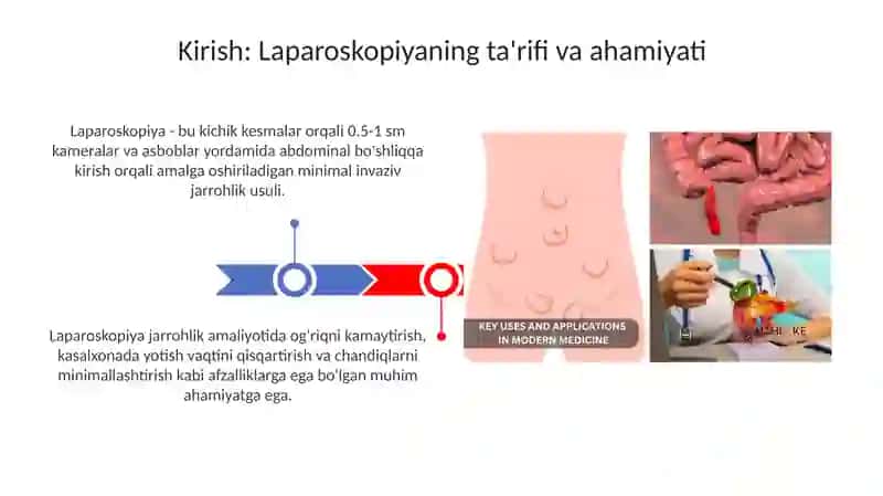 Laparoskopiya 3
