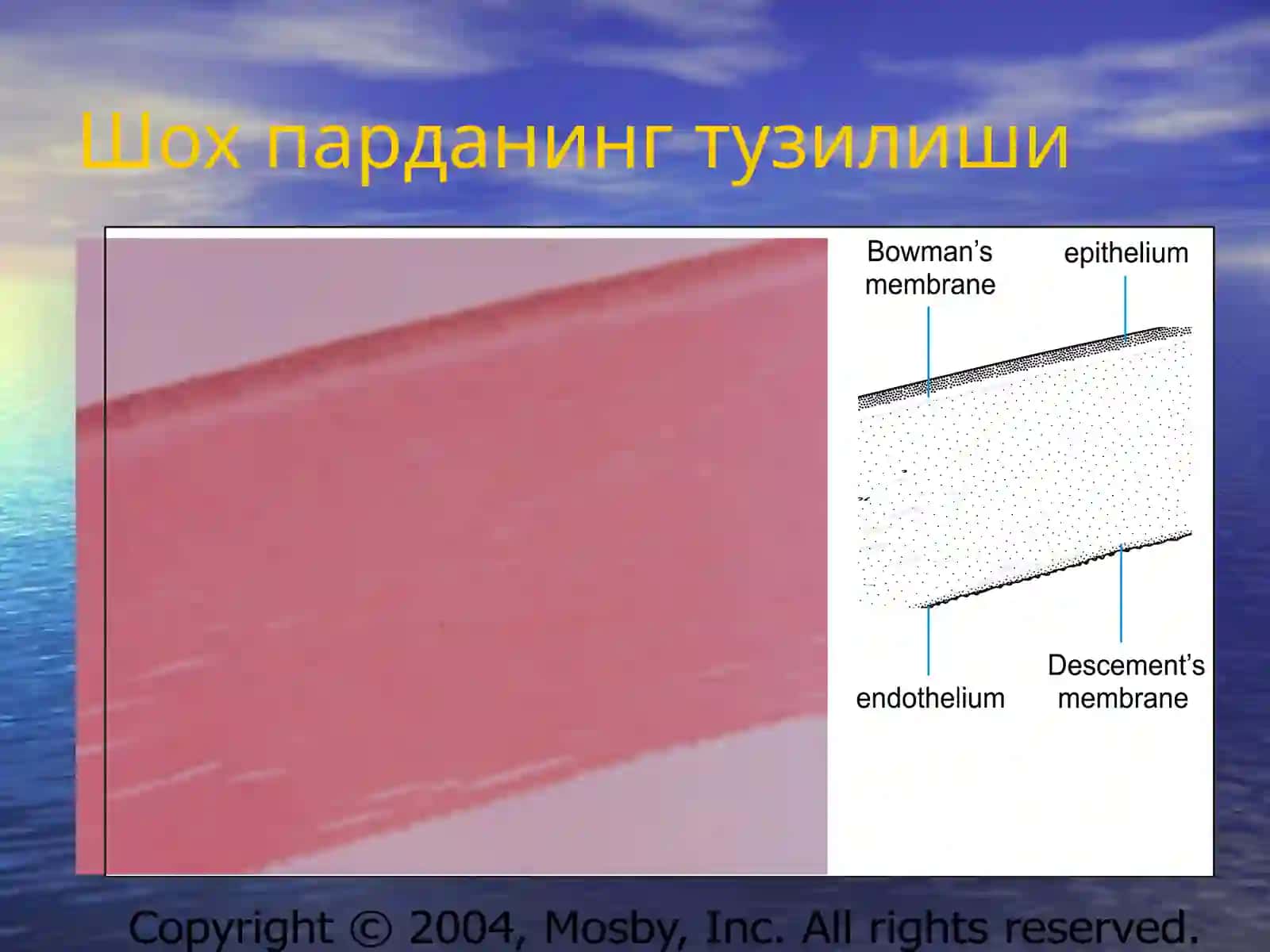 КЕРАТИТЛАР 3
